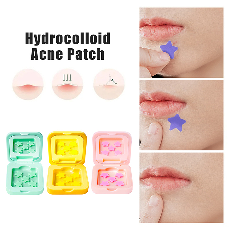 1Box Hydrocolloid Acne Patch F - đánh giá và giá Glass Break Detector